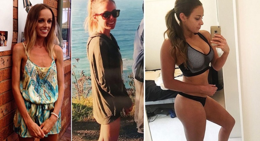 81-Pound Woman Struggling with Anorexia Became a Fitness Model on Instagram...